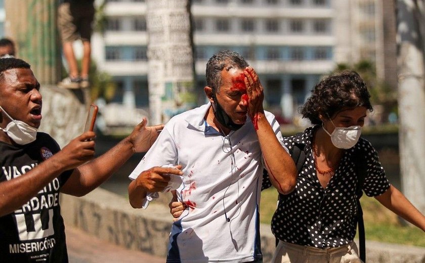 Dois homens atingidos pela PM com balas de borracha nos olhos perdem parte da visão