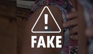 É falso que vacinas provoquem “efeito ímã” na pele