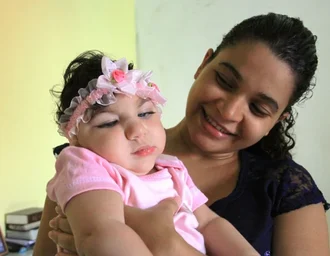 Crianças com microcefalia em Alagoas terão atendimentos médicos garantidos