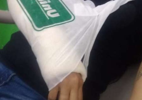 Passageira tem braço quebrado após freada brusca de ônibus