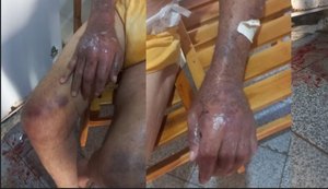 Filha é presa por maus-tratos e omissão de socorro contra idoso em Belo Monte