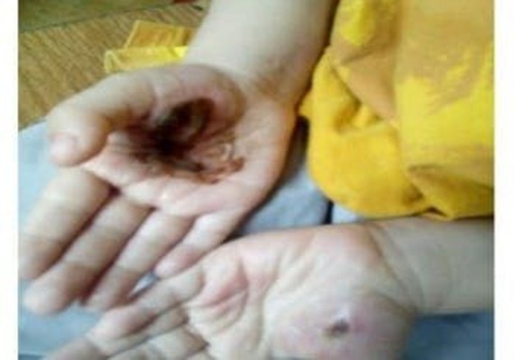 Justiça nega habeas corpus de mulher acusada de torturar filhos em Maceió