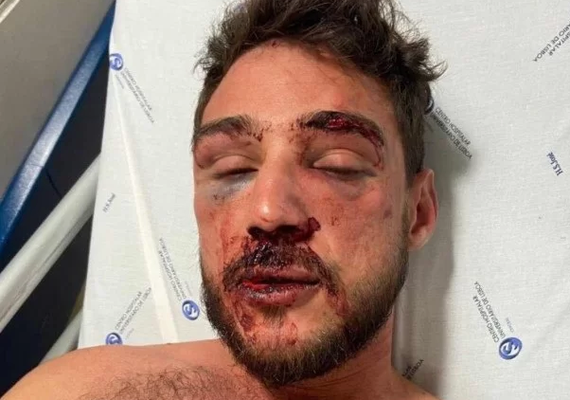 Arapiraquense e companheiro são brutalmente agredidos por seguranças de bar em Lisboa