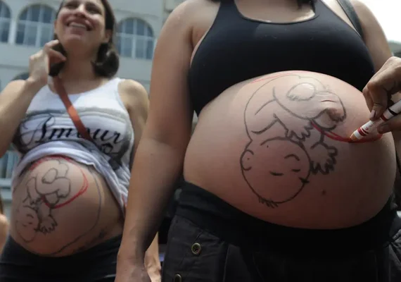 Fatores sociais e estruturais empurram mulheres para cesarianas