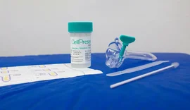 Guia orienta sobre mudança no rastreamento do câncer de colo do útero