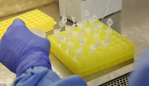 Rio confirma dois casos de sarampo na Baixada Fluminense