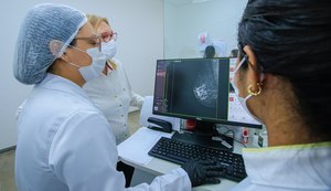 Uncisal disponibiliza 5 mil exames de mamografia até o fim do ano