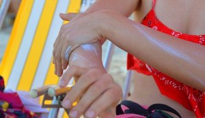 Dermatologista da Sesau dá dicas sobre cuidados com a pele no verão