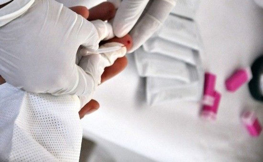 Unidades de saúde em Maceió oferecem testes rápidos para doenças virais
