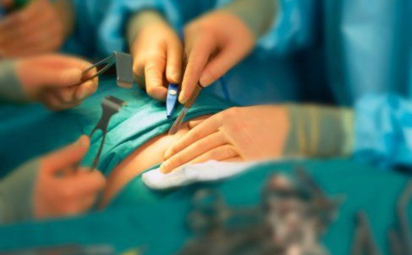 Ministério libera R$ 385,8 mil para cirurgias eletivas em Alagoas