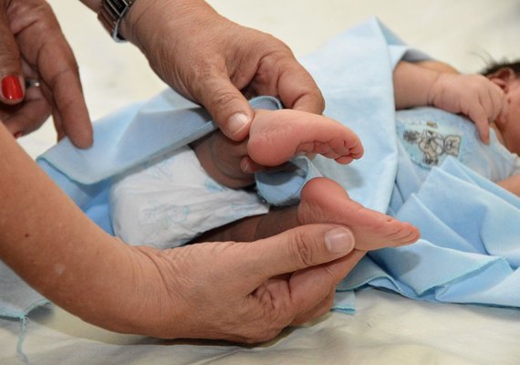Secretaria realiza mutirão de triagem para pacientes com pé torto
