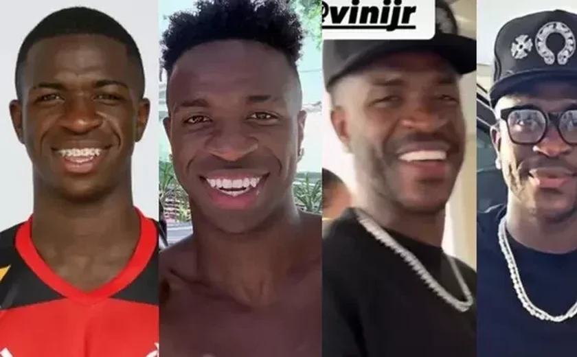 Antes e depois do craque Vini Jr: suposta harmonização, barba, novo sorriso e mais