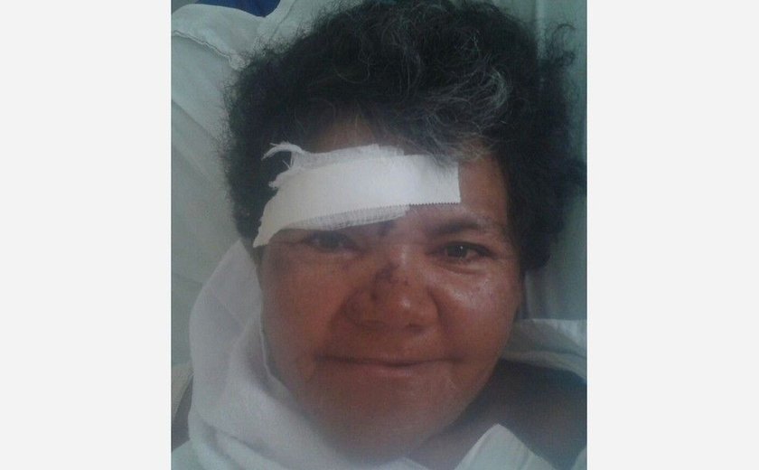 Hospital tenta localizar família de mulher de Campestre atropelada em Recife