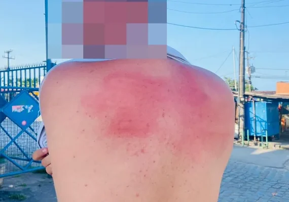 Jovem denuncia agressão causada por agentes do Programa Ronda no Bairro