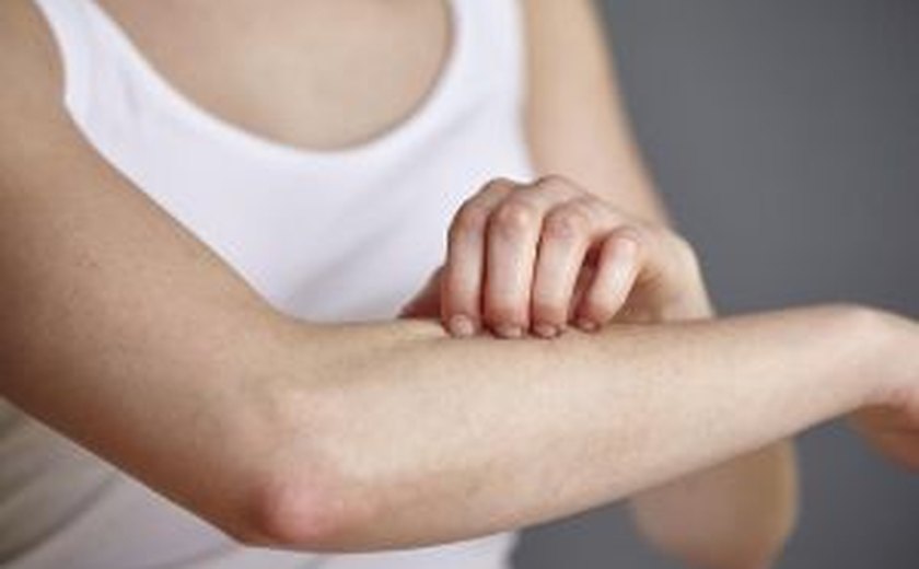 Brasil registra mais de 22 mil novos casos de hanseníase no ano; doença tem cura e tratamento gratuito pelo SUS