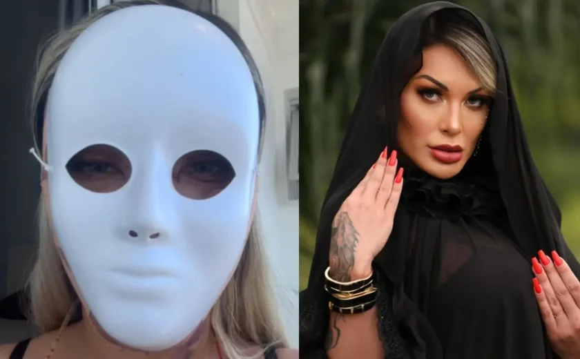Influenciadora Andressa Urach mostra novo rosto após 50ª plástica: 'Voltar a 23 anos'