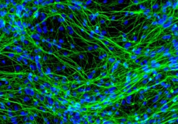 Descoberto o caminho neural causador da ansiedade