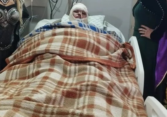 Após ficar semanas em coma, mulher acorda, acusa marido de tê-la queimado e morre logo depois