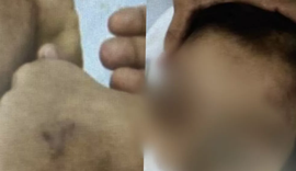 Inquérito policial que investiga caso de criança de 5 anos espancada pelo pai fica pronto em 10 dias