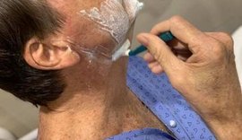 Jair Bolsonaro tem alta da Unidade Semi-Intensiva