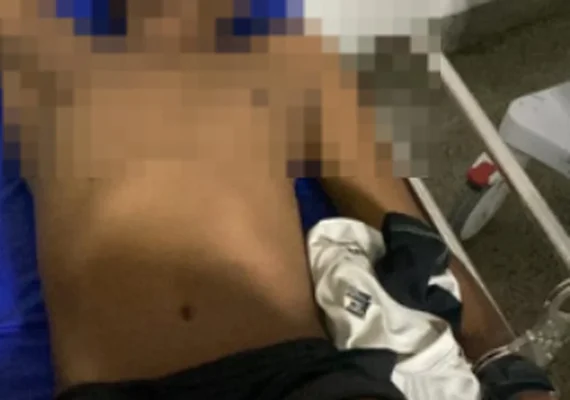 Suposto envolvido na morte de um  sargento reformado da PM dá entrada no HGE com tiro na perna