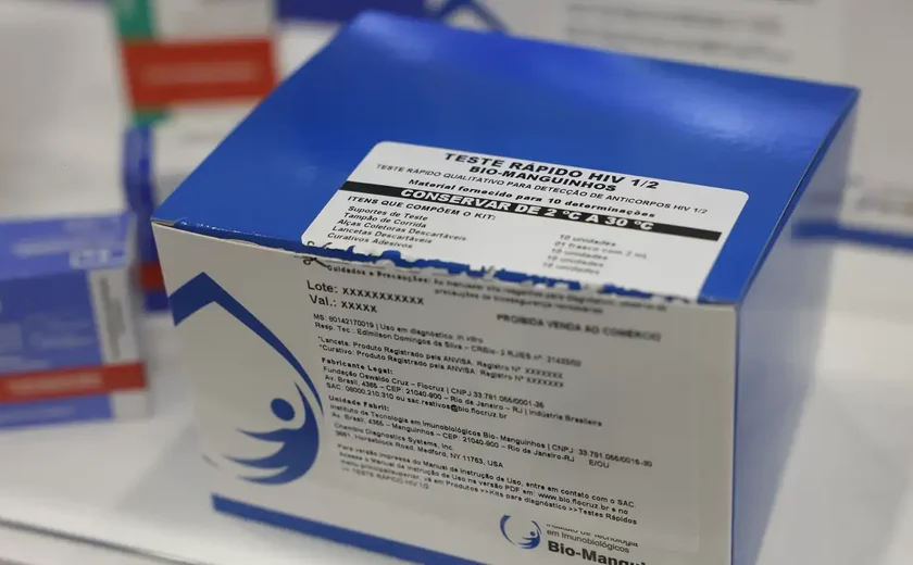 Fiocruz vai ampliar produção de kits diagnósticos para o SUS