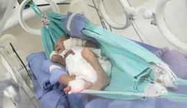 Bebês prematuros de Hospital em Arapiraca descansam em redes