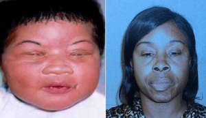Bebê sequestrada em hospital dos EUA é encontrada após 18 anos