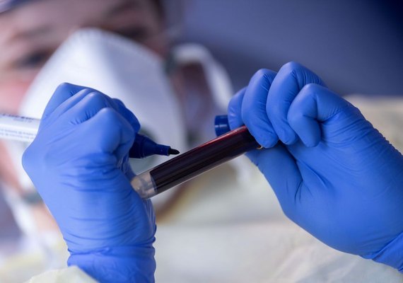 Alagoas registra 422 novos casos de Covid-19 e nove mortes nas últimas 24 horas