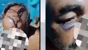 Polícia Civil prende autores de tentativa de latrocínio contra idoso de 60 anos em Coruripe