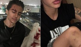 Biel é acusado de agredir mulher e divulga vídeo da briga