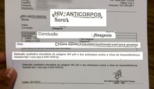 Laboratório é condenado a indenizar em R$ 20 mil por resultado errado de HIV