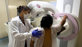 Sesc Saúde Mulher oferece mais de 1.800 exames gratuitos em Maceió