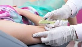 Ministério da Saúde vai qualificar 230 profissionais em Alagoas para ampliar a oferta de implante contraceptivo