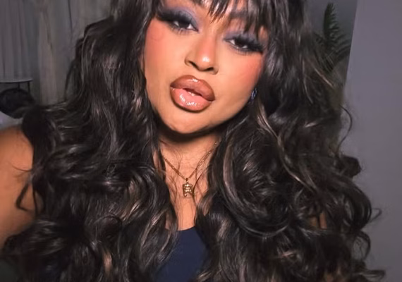 Ex-BBB alagoana sofre acidente com moto elétrica e relata fratura no olho