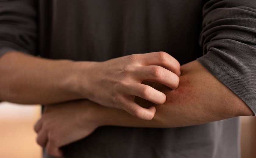Dermatologista alerta que sinais na pele podem revelar doenças sistêmicas