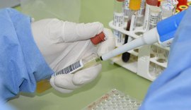 Sesau orienta população sobre riscos, prevenção e tratamento da doença de Chagas