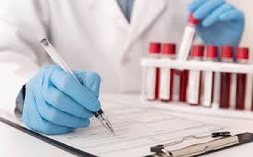 Alagoas tem 481 laboratórios e três falhas registradas em análises clínicas, aponta ANVISA