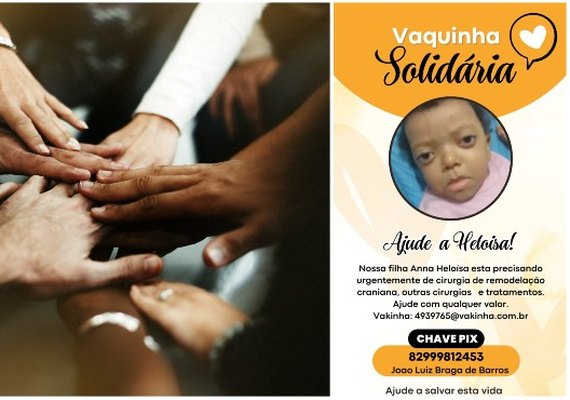 Campanha solidária arrecada recursos para cirurgias de Anna Heloísa, de 3 anos
