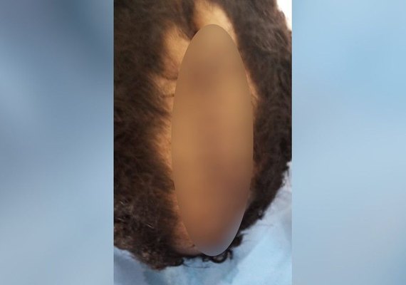 Pai corta couro cabeludo do filho com faca e alega que era de 'homossexual''