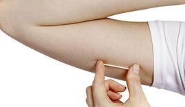 Adolescentes passam a ter acesso gratuito ao implante contraceptivo