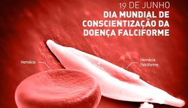 Doença falciforme soma 800 casos em Alagoas e reforça alerta por assistência adequada