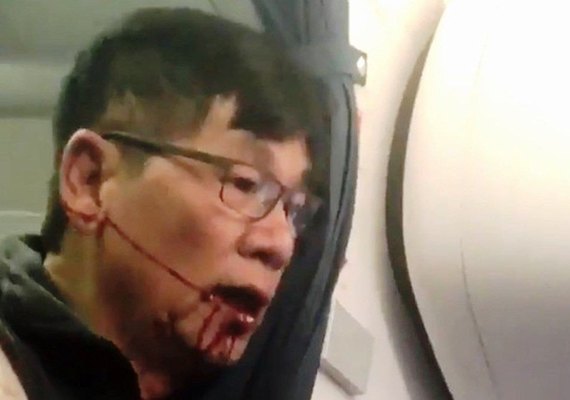 Passageiro tirado à força de avião faz acordo com a companhia