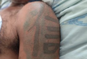 Hospital de Emergência do Agreste tenta localizar familiares de paciente sem identificação