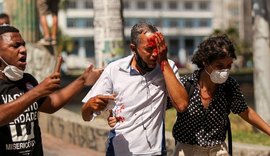 Dois homens atingidos pela PM com balas de borracha nos olhos perdem parte da visão