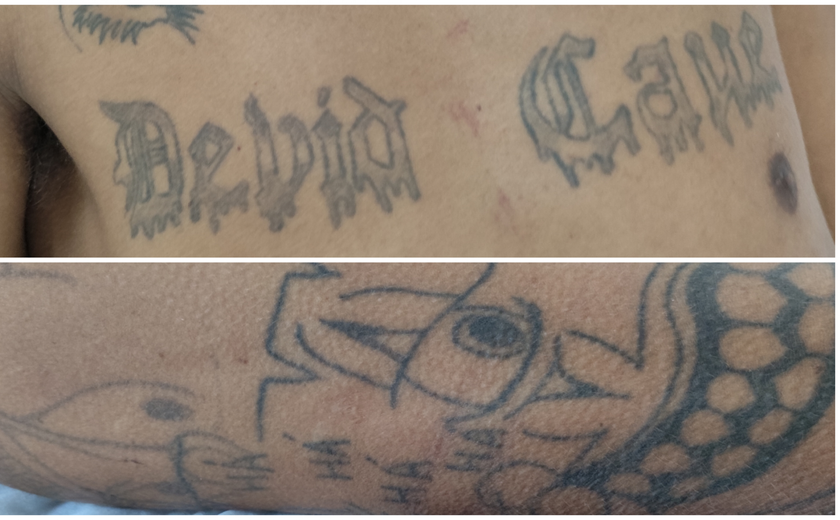 Hospital de Emergência do Agreste procura familiares de paciente identificado apenas como Rafael