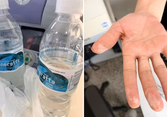 'Achei que era uma água com gás muito ruim', diz homem internado com sintomas de intoxicação no interior de SP