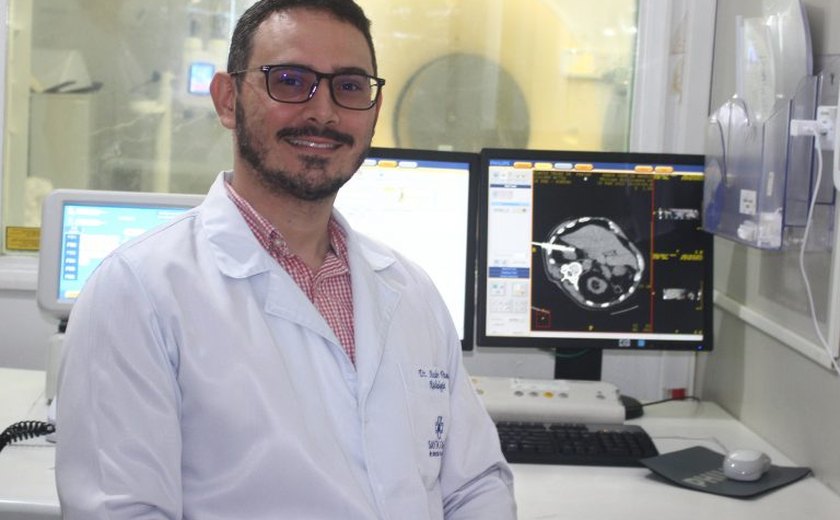 Santa Casa de Maceió inicia crioablação para tratamento de tumor renal