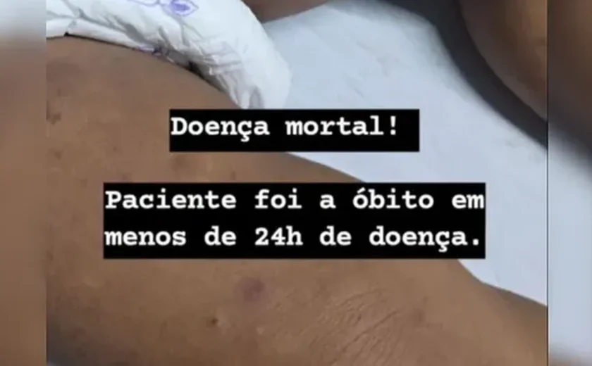 Criança de um ano morre em menos de 24 horas  após apresentar sintomas de meningite em Maceió