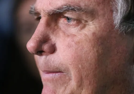 Com crise persistente de soluços, Bolsonaro passa por nova cirurgia